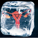Freezing Ovaries For Preserving Fertility Is On The Rise and Other Stories