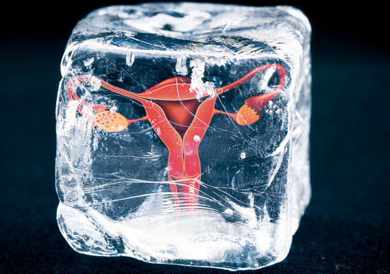 freezing ovaries for preserving fertility